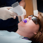 Intraoral Camera in use