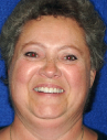 Happy Novato Dental Patient 1