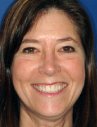 Happy Novato Dental Patient 3