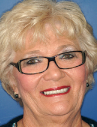 Happy Novato Dental Patient 7