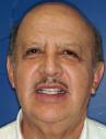 Happy Novato Dental Patient 8