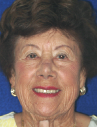 Happy Novato Dental Patient 9